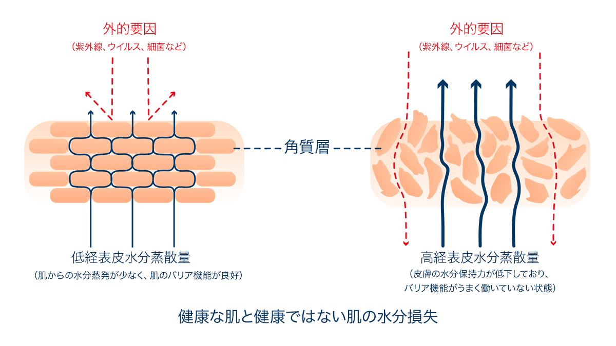 健康な肌と健康ではない肌を比べた水分損失図